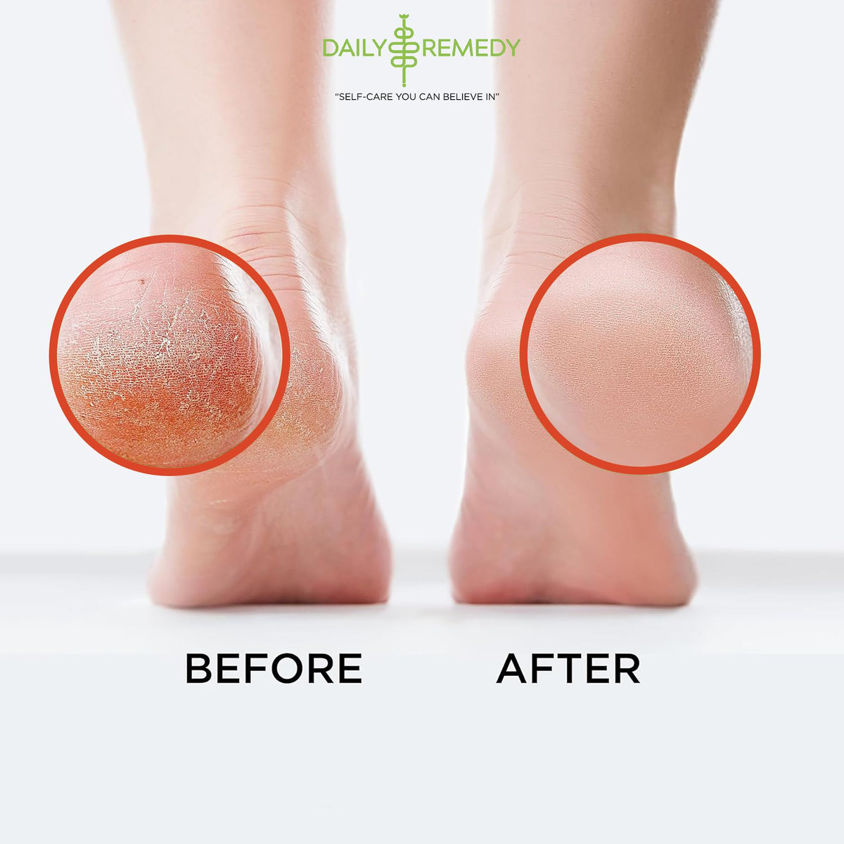 Muscle Relief Foot Soak with Epsom Salt, Made in USA, Soothe Foot Aches, Muscle Pain DAILY REMEDYBuy Supplements Australia