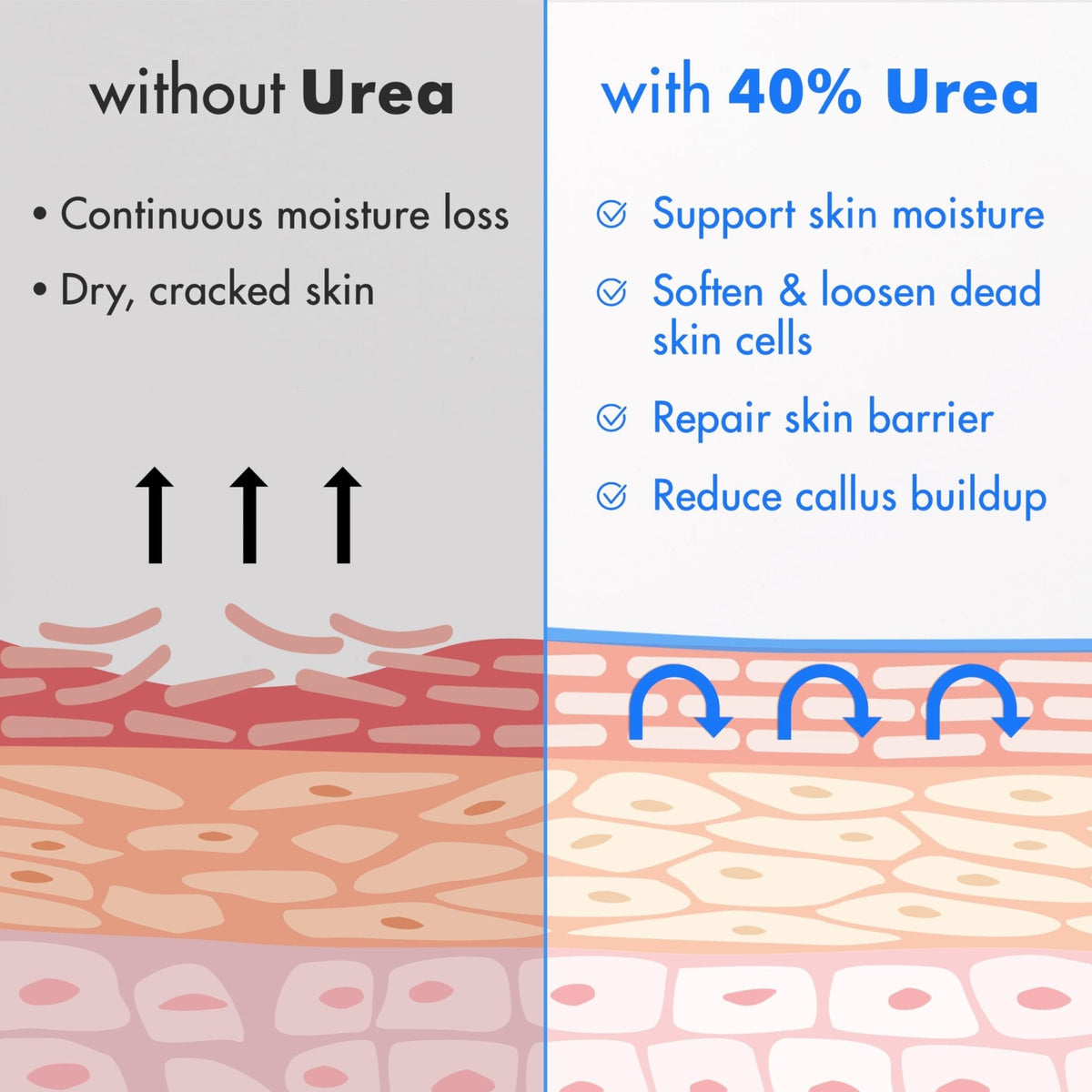 Ebanel Urea Cream 40% plus Salicylic Acid 2%, Foot Cream for Dry Cracked Heels Feet Knees Elbows Hands, Foot Dead Skin Cuticle Callus Remover Toenail Softener, Keratolytic Skin Barrier Repair - Maple Wellness Supplements