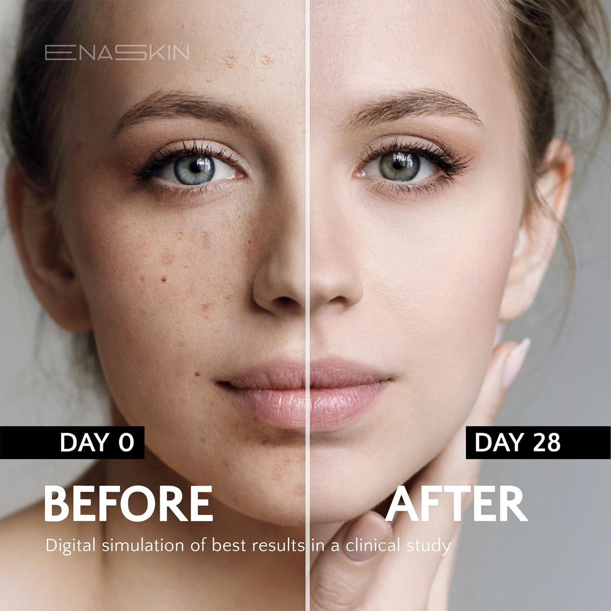 EnaSkin Dark Spot Remover Face & Body Serum: Age Spot Sun Spot Freckles Melasma Brown Spot - Maple Wellness Supplements