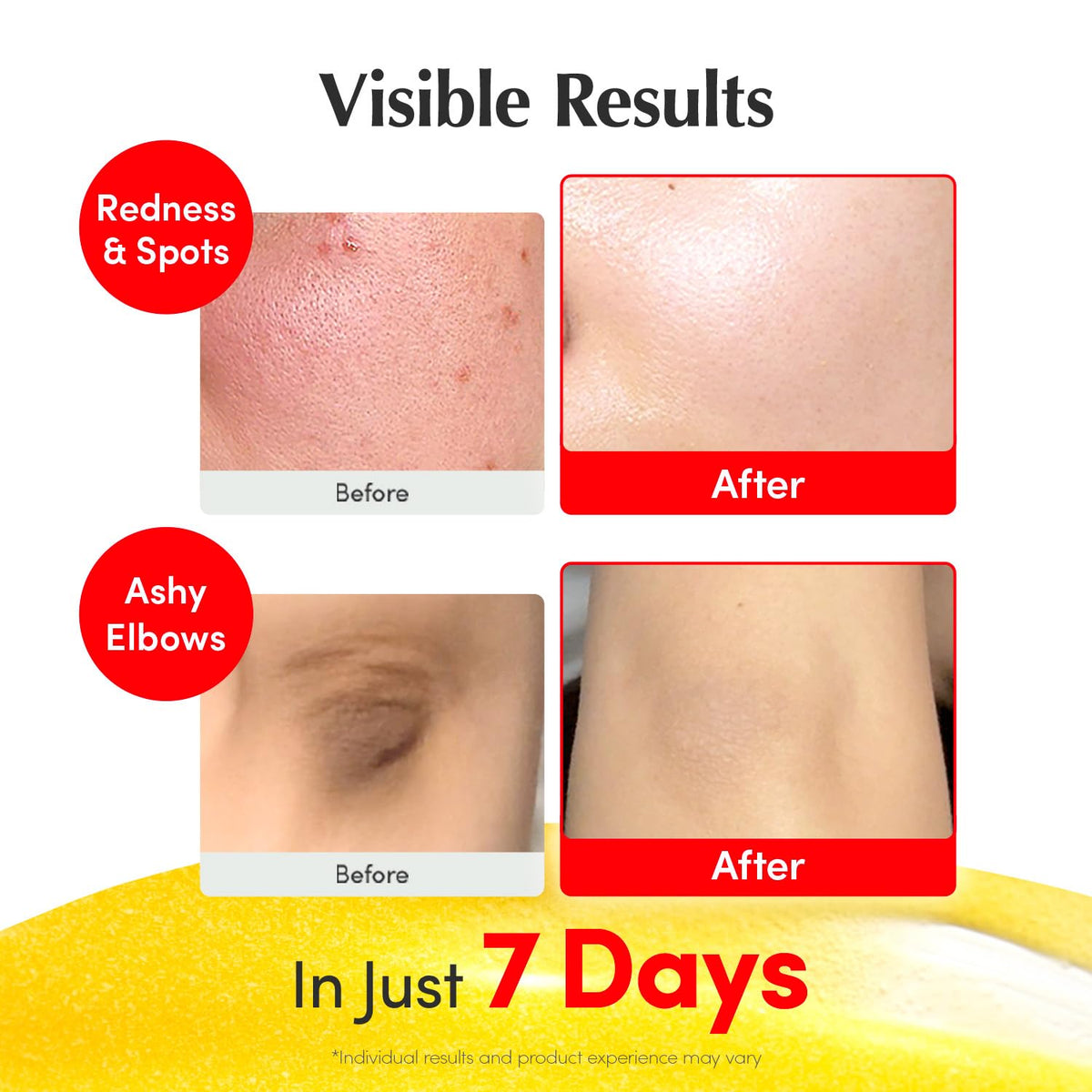 Buy ​EQQUALBERRY Vitamin Illuminating Serum | Niacinamide 4% + Brightening Vitamin C Face - Vitaza UK Supplements UK