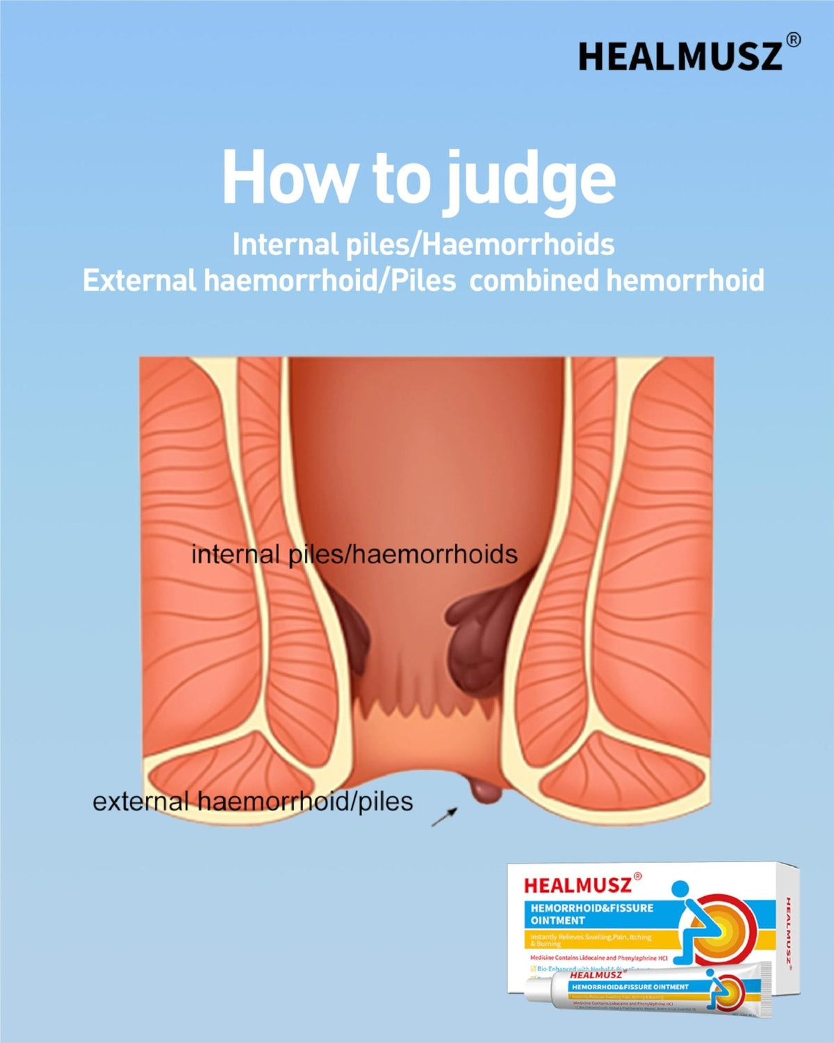 HEALMUSZ Hemorrhoid Fissure Ointment– Hemorrhoid Treatment and Hemorrhoid Cream with Lidocaine and Phenylephrine HCI for Fast Acting Relief of Pain, Swelling, Discomfort, and Itching(1.5 oz) - Maple Wellness Supplements