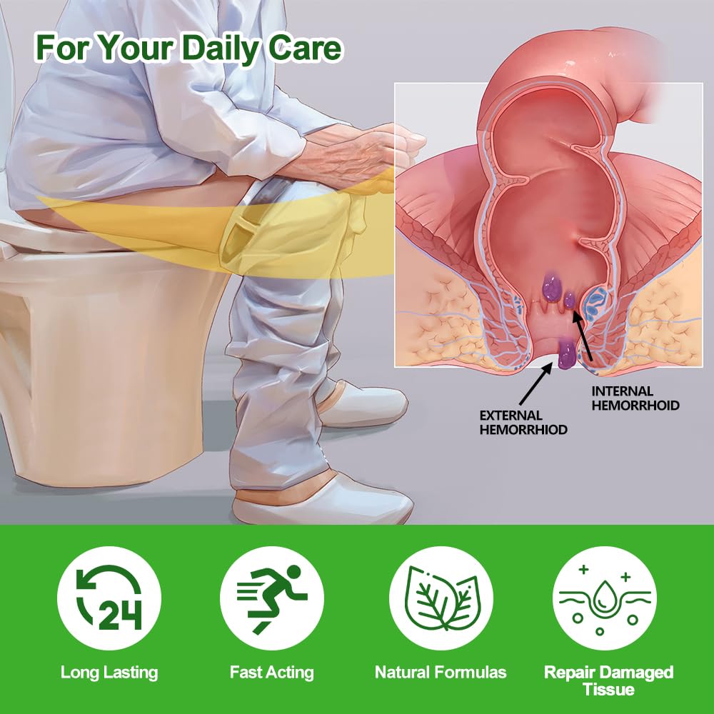 RHAICARE Hemorrhoid and Fissure Treatment Cream,Hemorrhoidal Ointment for Fast Acting Itch, Swelling, and Maximum Strength Pain Relief - Maple Wellness Supplements