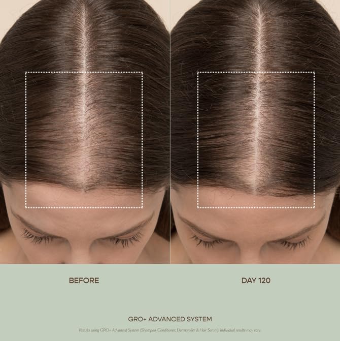 VEGAMOUR GRO+ Advanced Essentials Kit | Removes Buildup, Improves Hair Density, Reduces Shedding, Hydrates and Exfoliates the Scalp | For Severe Signs of Thinning | Color Safe, Vegan, Cruelty-Free - Maple Wellness Supplements