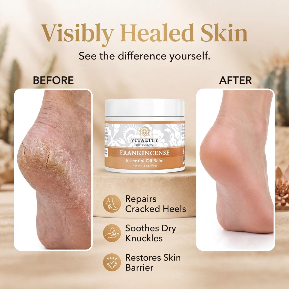Vitality Extracts Frankincense Balm - 2oz, Boswellia Serrata, Beeswax, Olive Oil, Moisturizer for Dry, Cracked Skin, All Skin Types - Maple Wellness Supplements